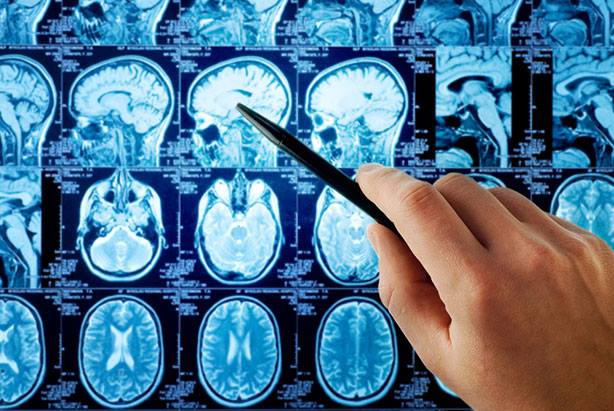 Brain tumour treatment information: neurosurgery